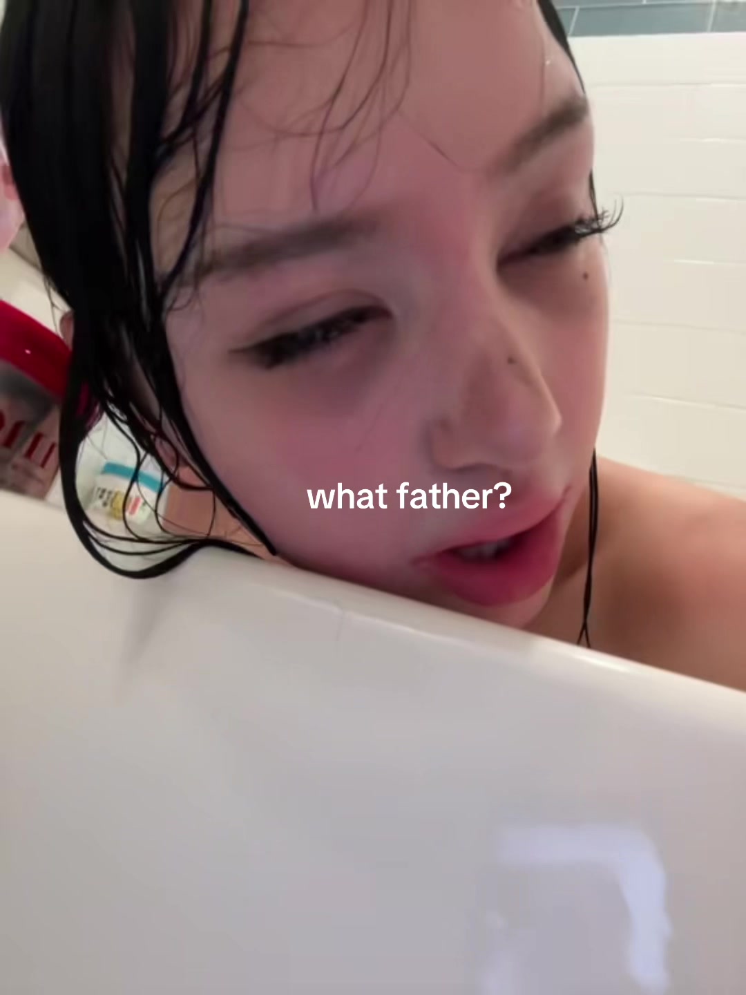 @Anoi