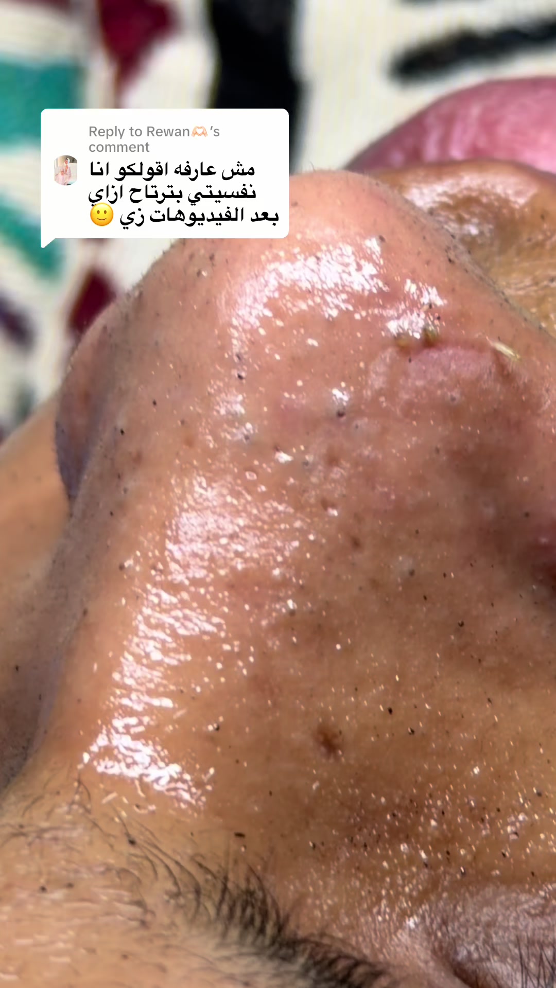 @menna_skintherapist