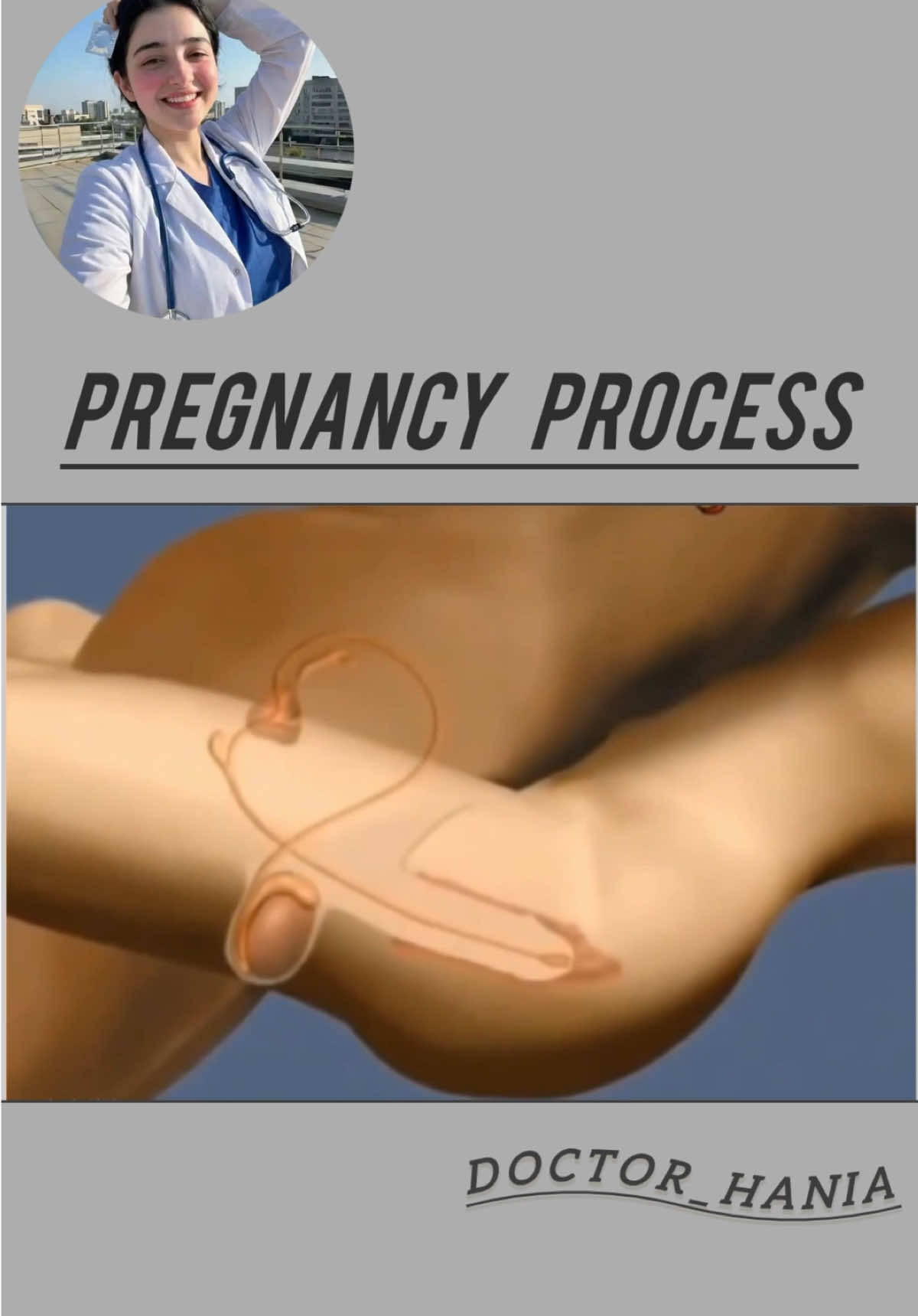 @Doctor Hania