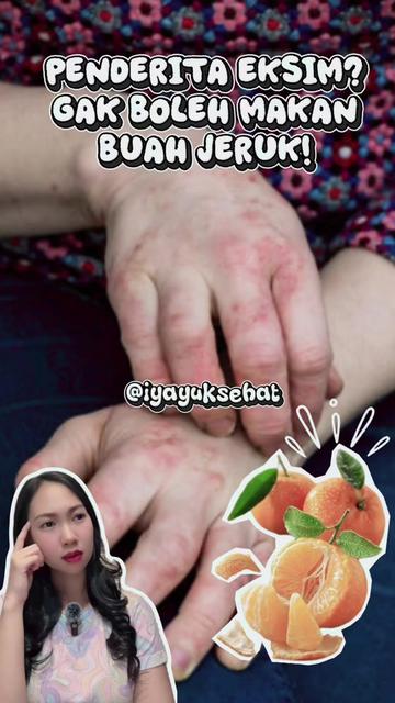 @Iya Bahas Eksim
