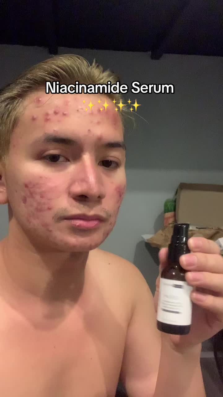 @Trebb🧿🪬