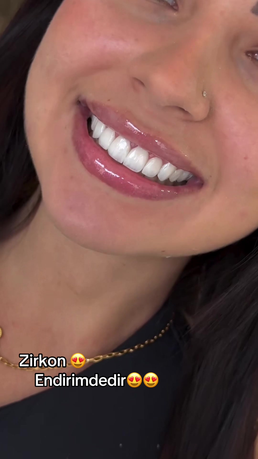 @𝐁𝐚𝐲𝐃𝐞𝐧𝐭𝐄𝐥𝐢𝐭𝐞🦷