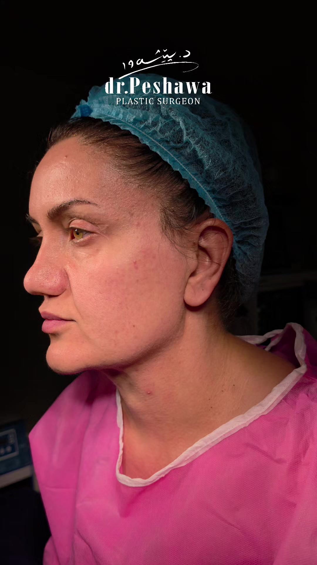 @Dr. Peshawa Plastic Surgeon
