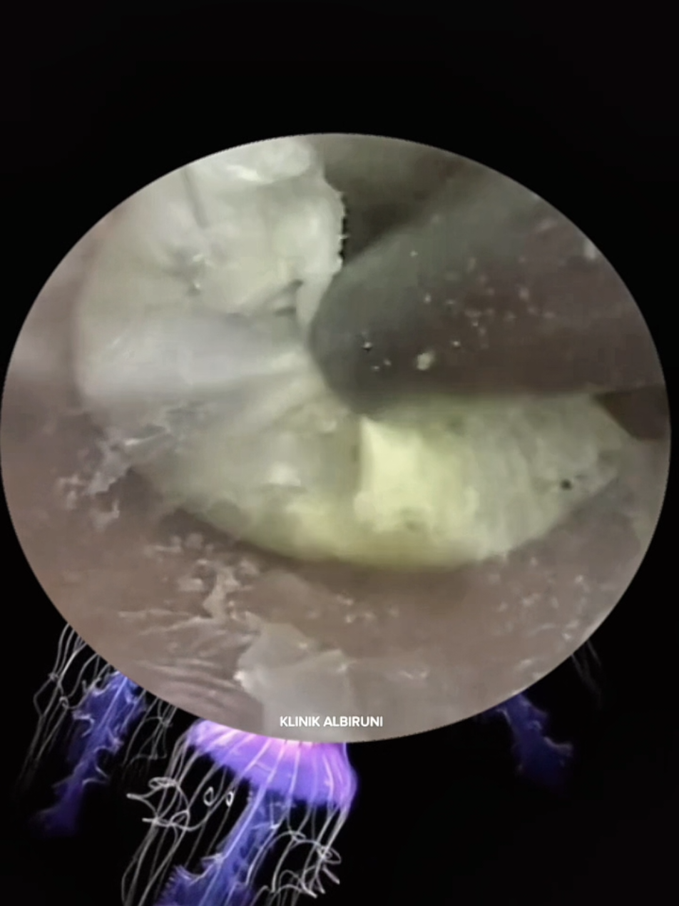 @Earwax.pro