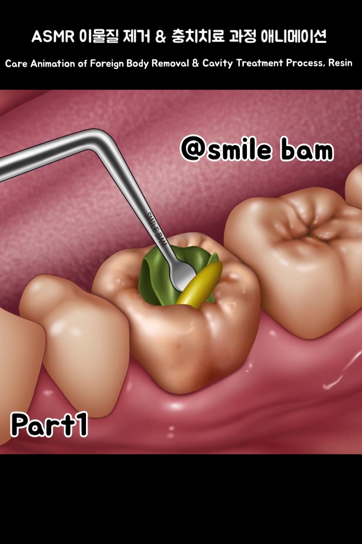 @Smile Bam