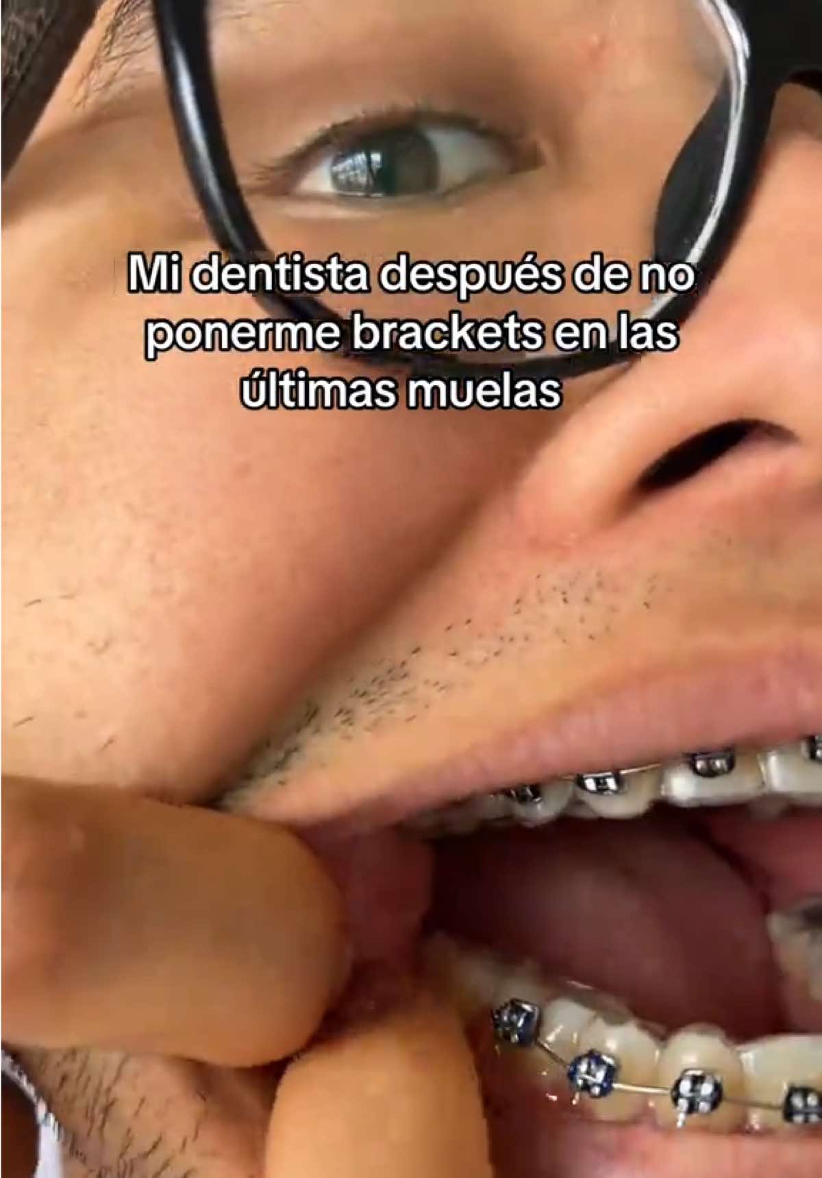 @Lin Yan Chimuelo