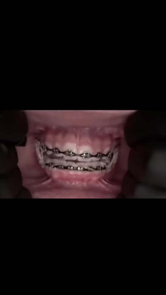@⭐️//-Asher-//🦷