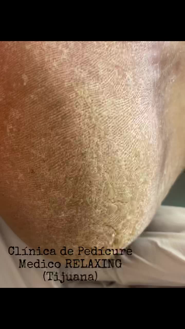 @Carmen Serrano