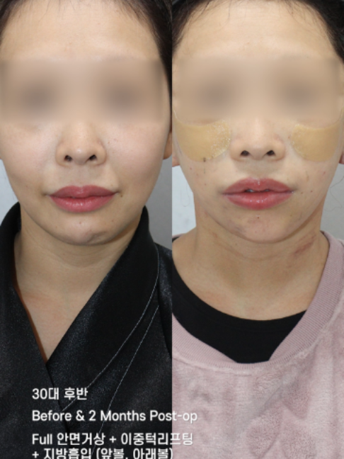 @다시피움성형외과 DASIPIUM タシピウム