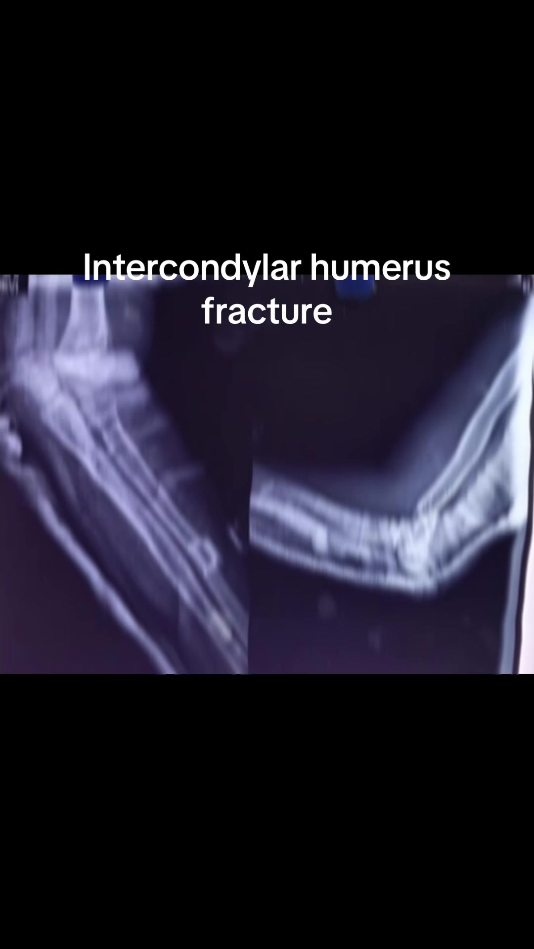 @Spine_Ortho_Surgeon_Arbind