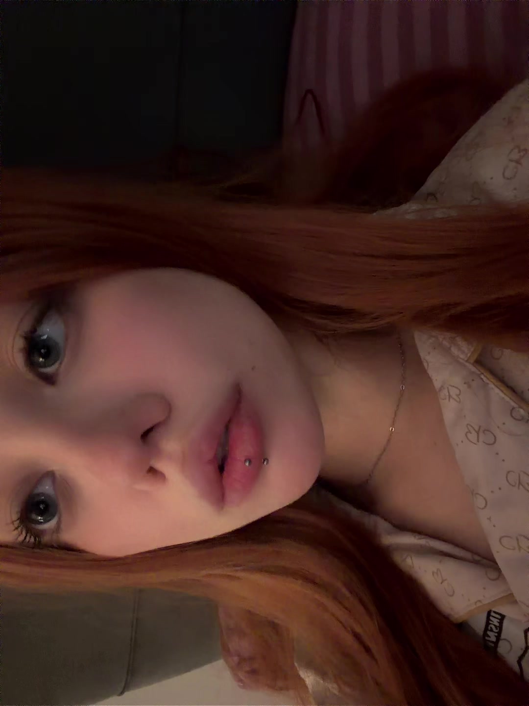 @глаукома