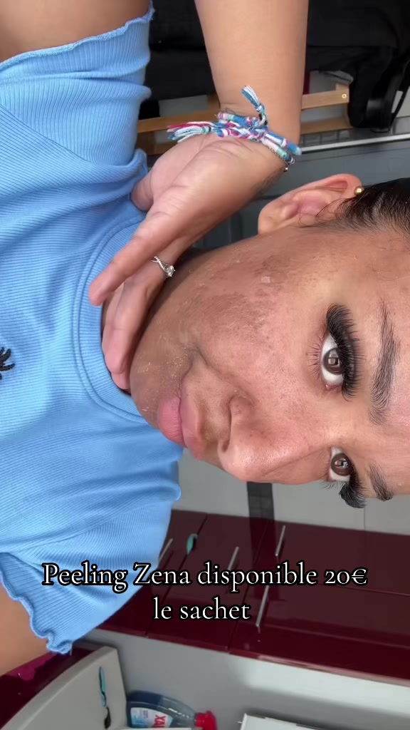 @peeling_zena