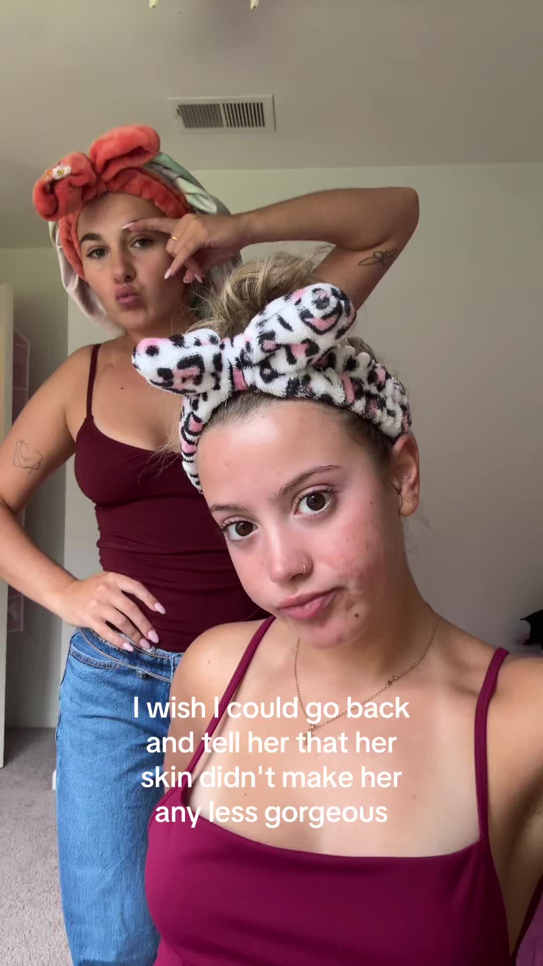 @cheeto🙈