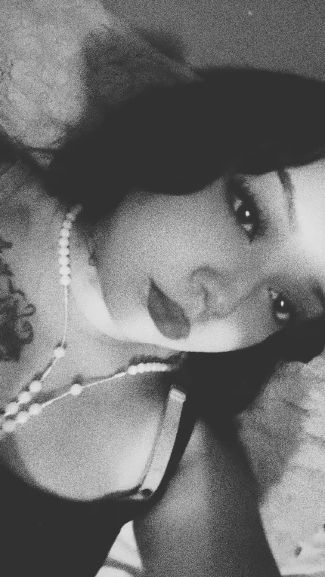 @$Angeleye$