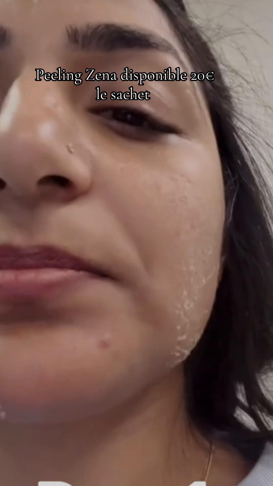 @peeling_zena