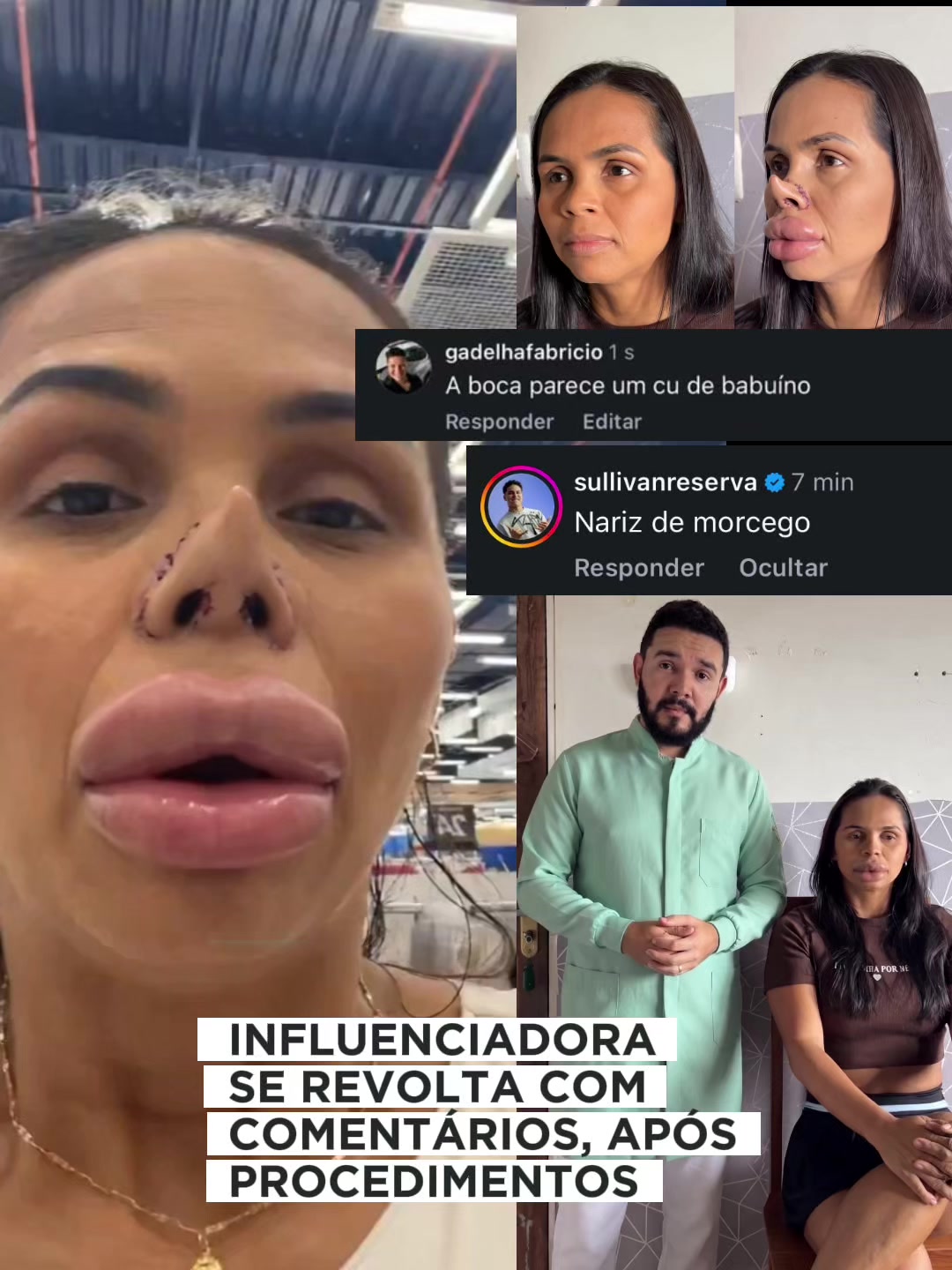 @Esdras Amorim