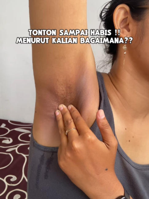 @ArunikaCare