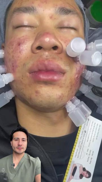 @chrisantiage