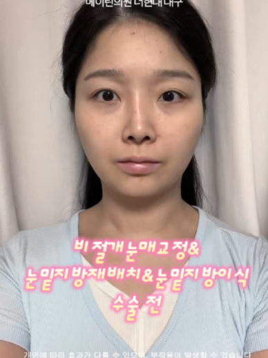 @메이린의원대구점