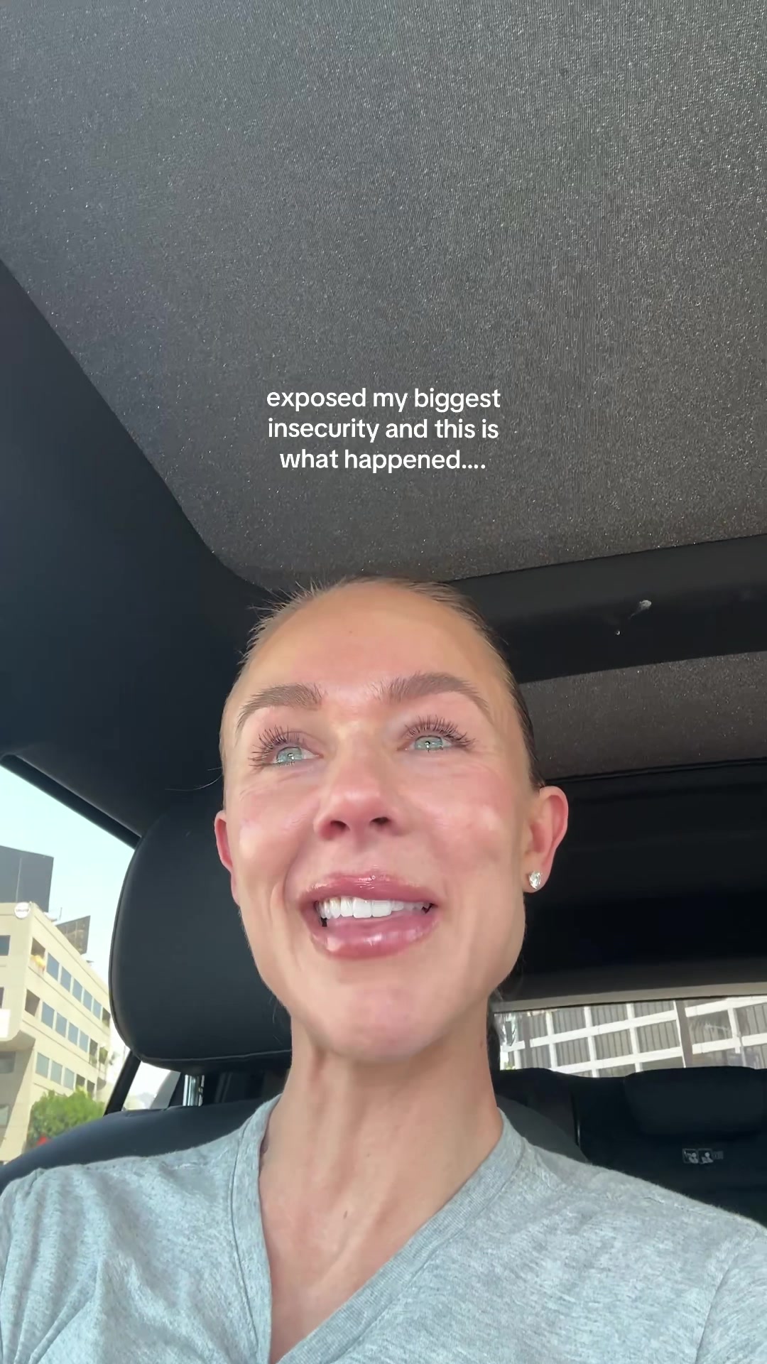@Celeste | RN acne expert