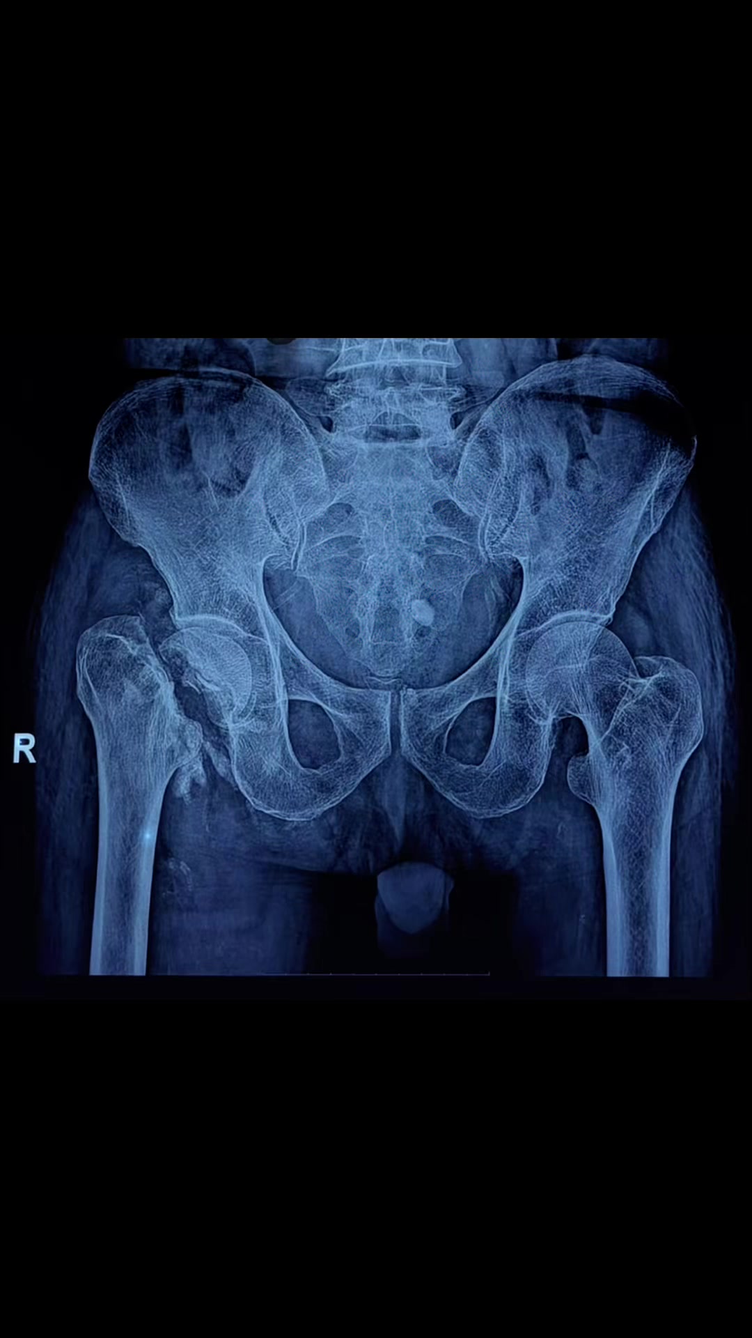 @Spine_Ortho_Surgeon_Arbind
