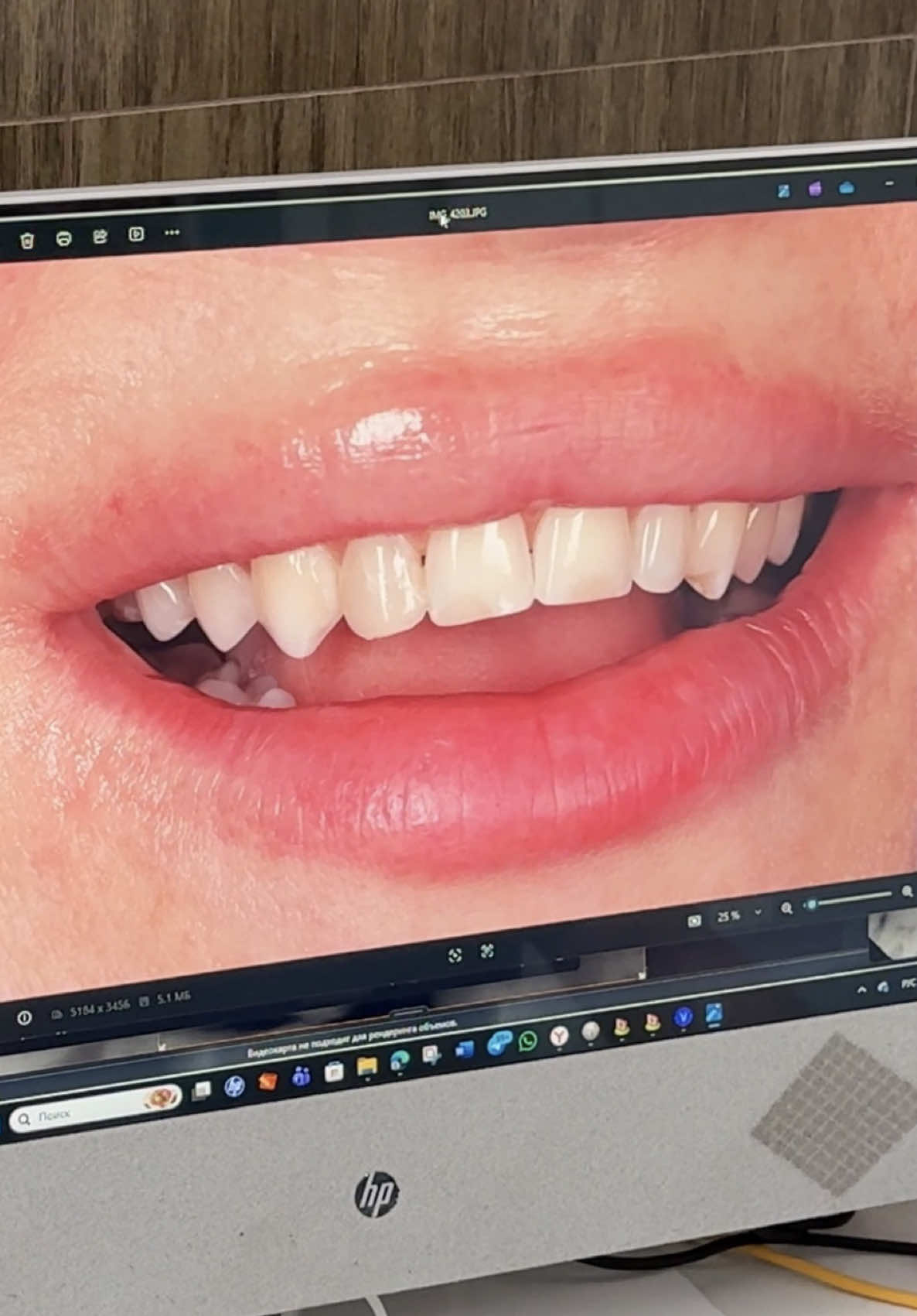 @Emma
