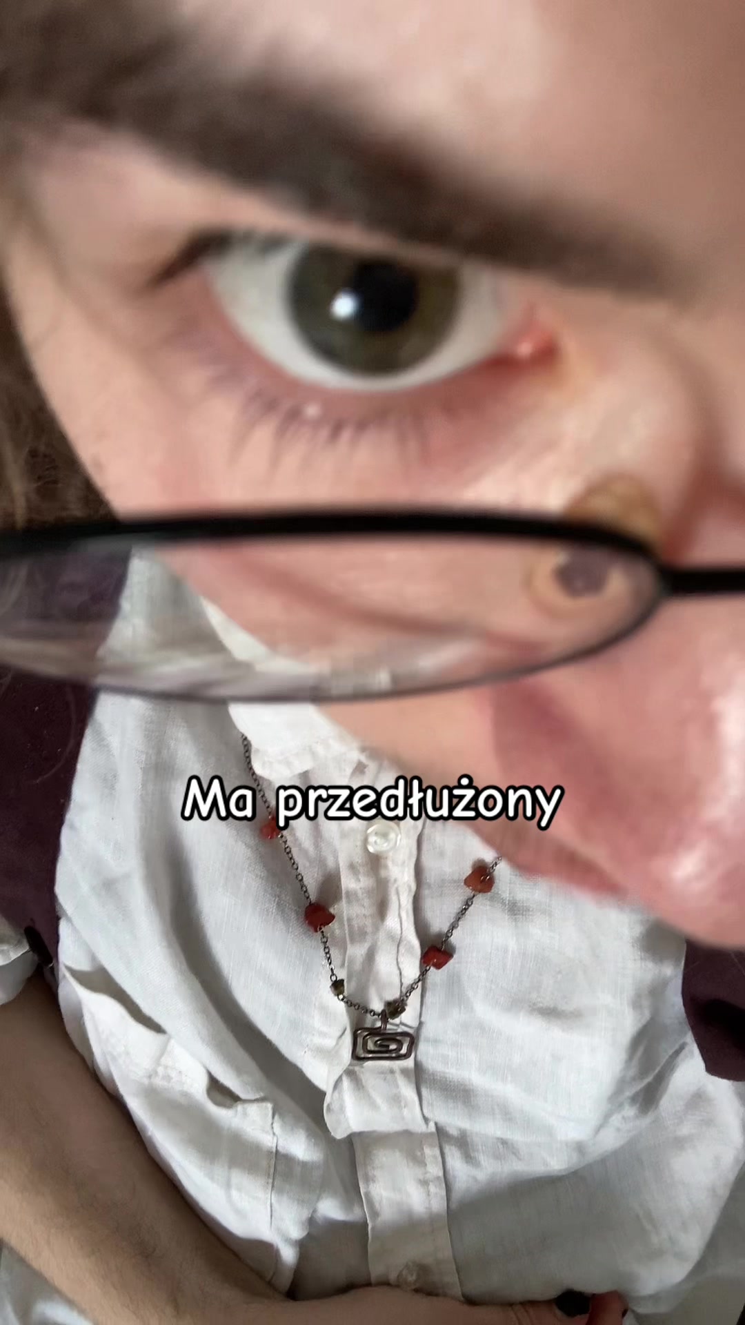 @SkierCon