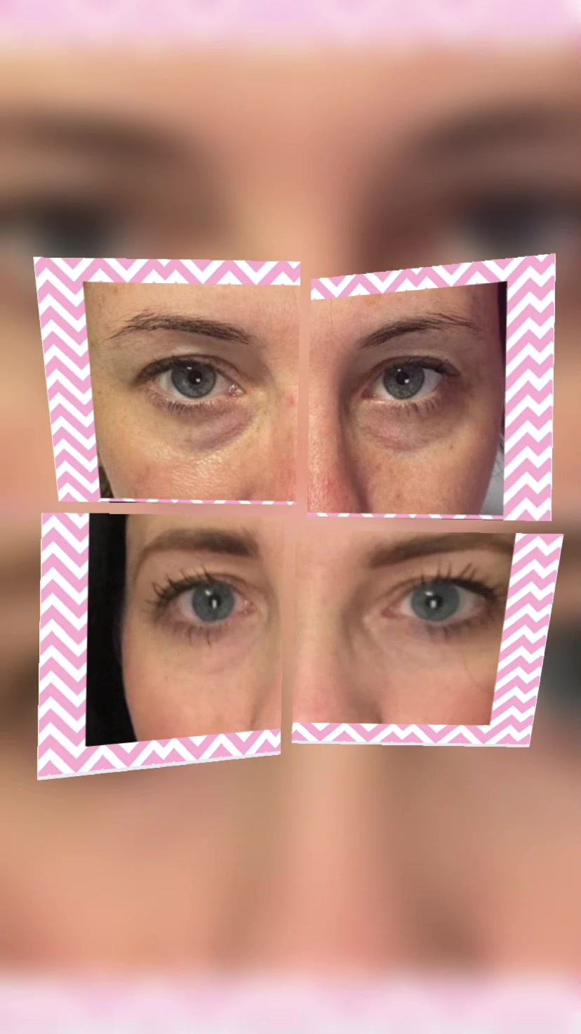 @Diamond Aesthetics Barnsley