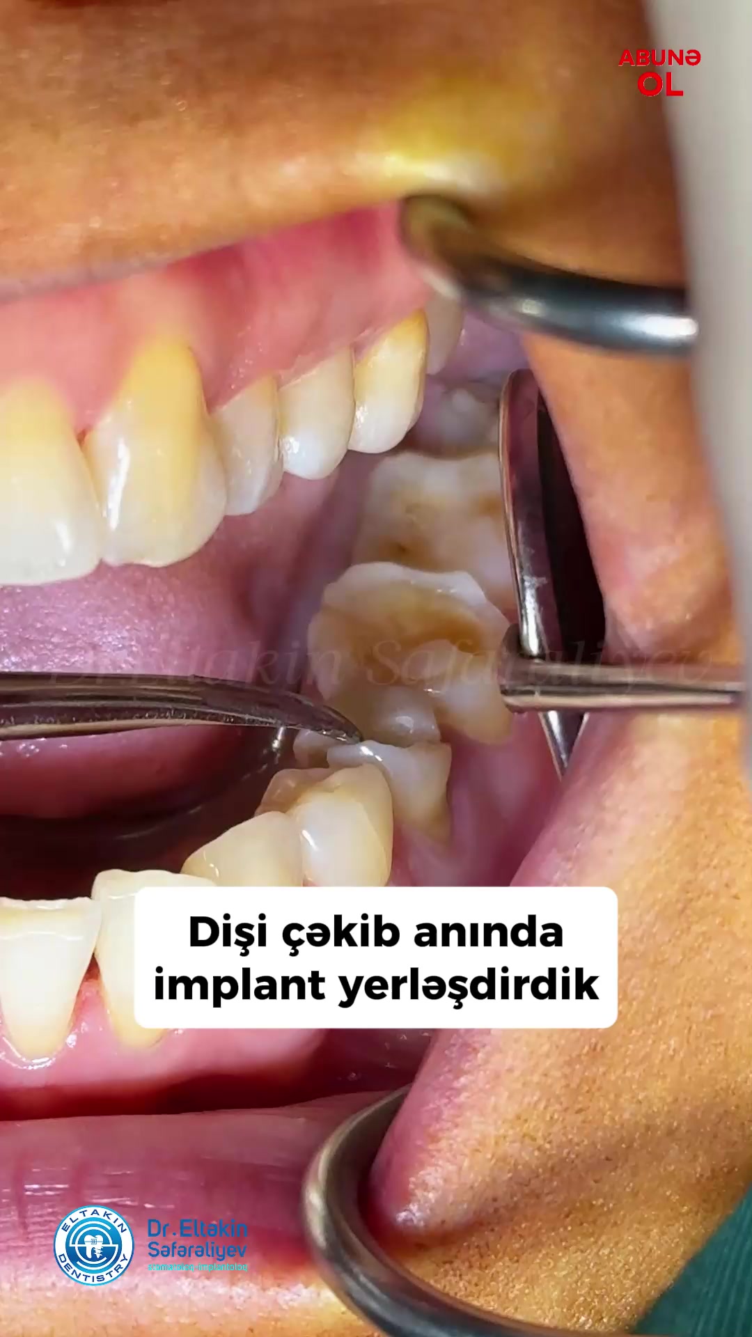 @eltakindentistry
