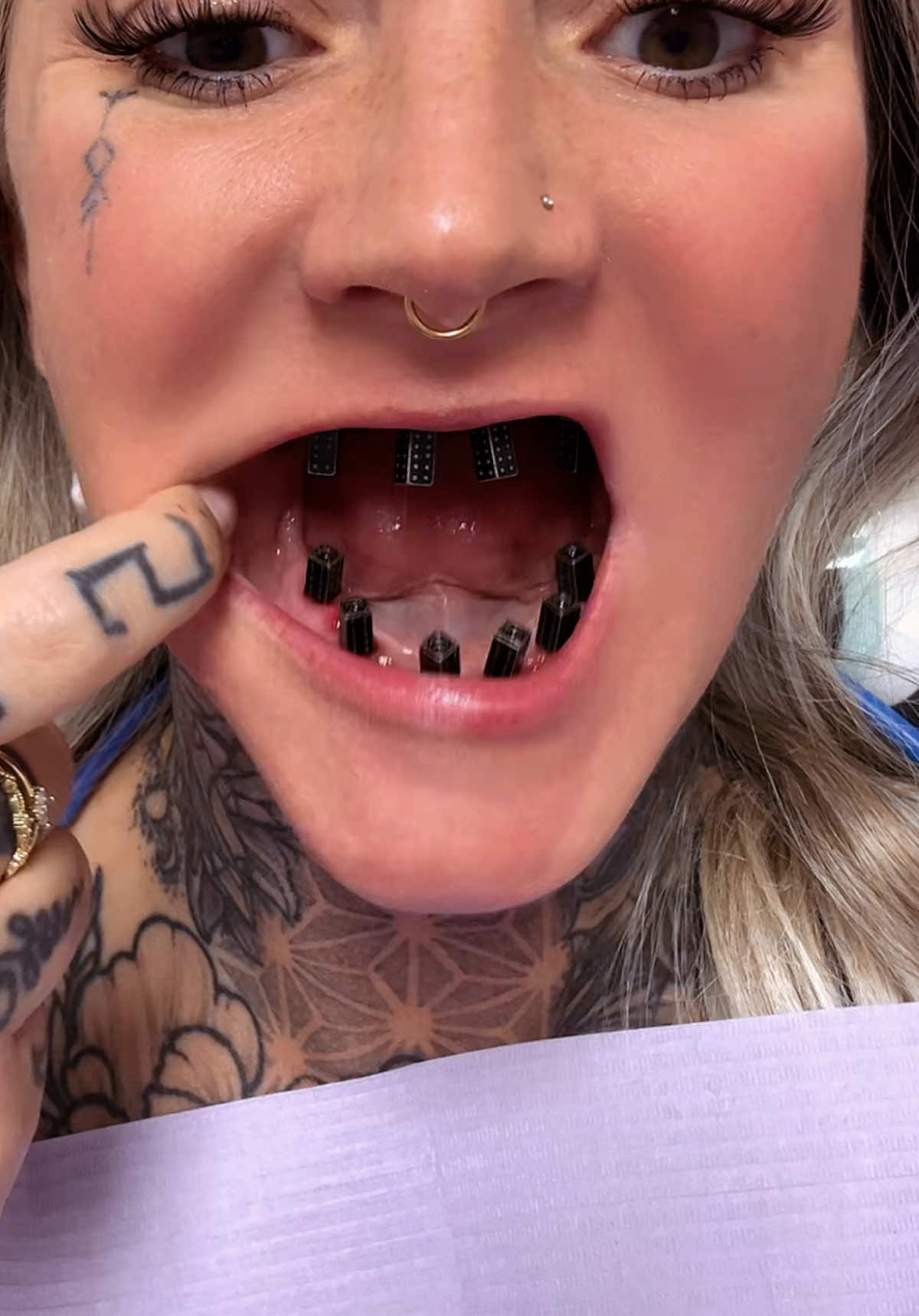 @denturegirly OG