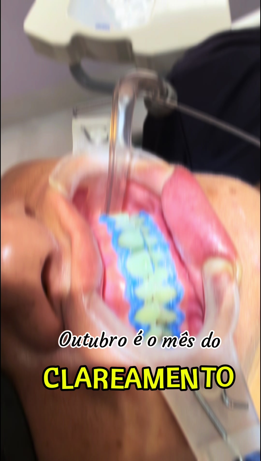 @Glaucivania