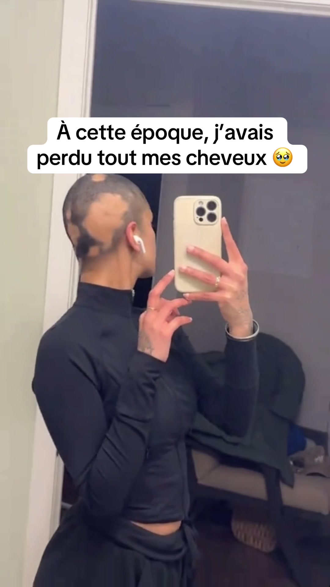 @Lux’Hair Growth