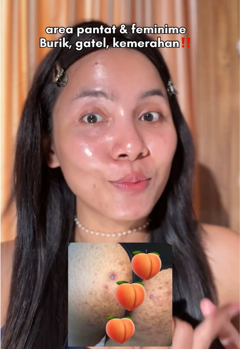 @Deenish_