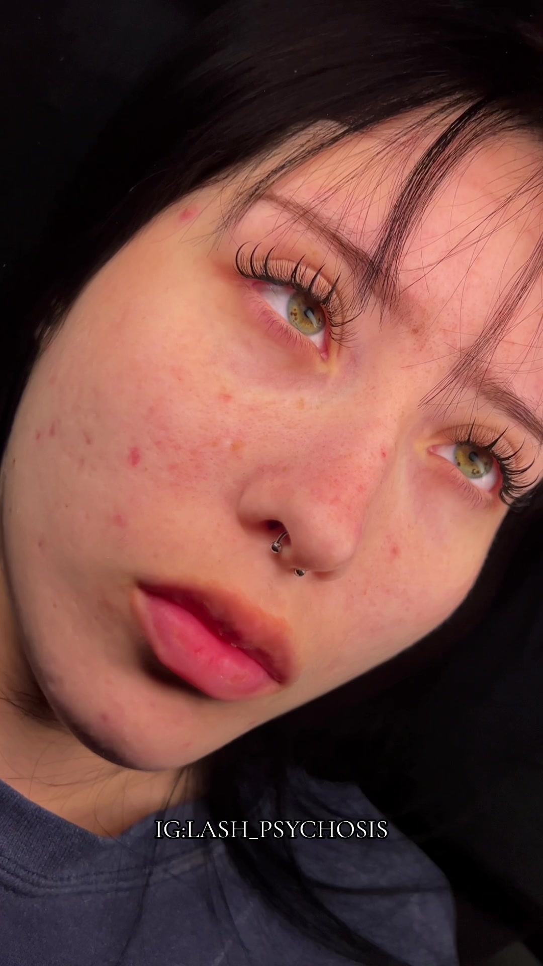 @Lash_psychosis