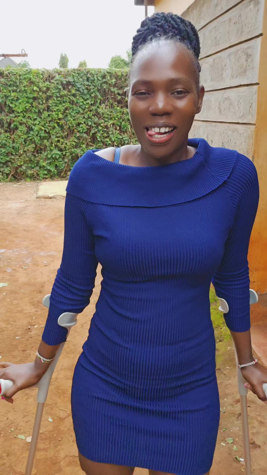 @💎Nattie Amputee🇰🇪♊️