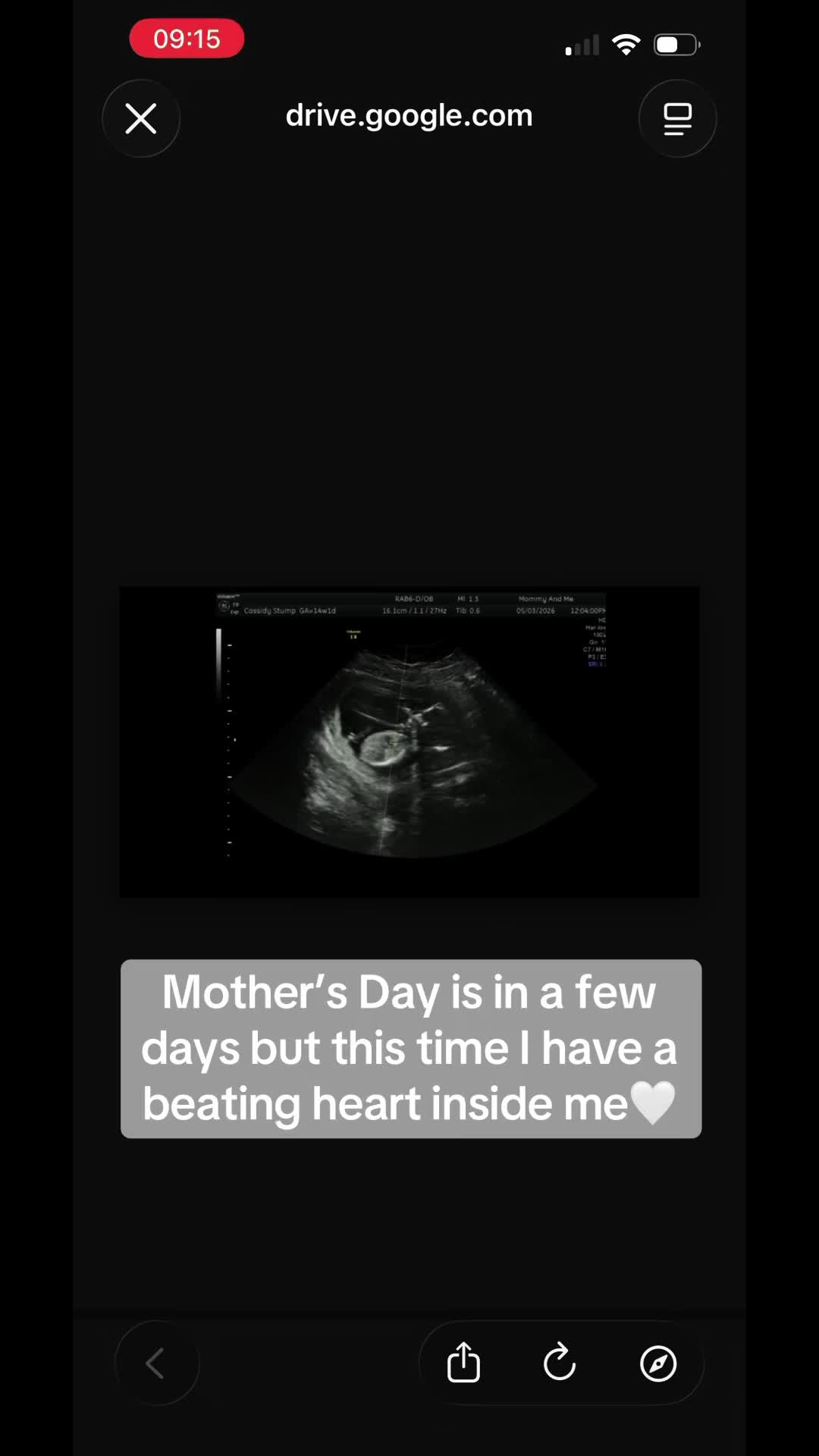 @Cassidy | IVF Pregnancy I
