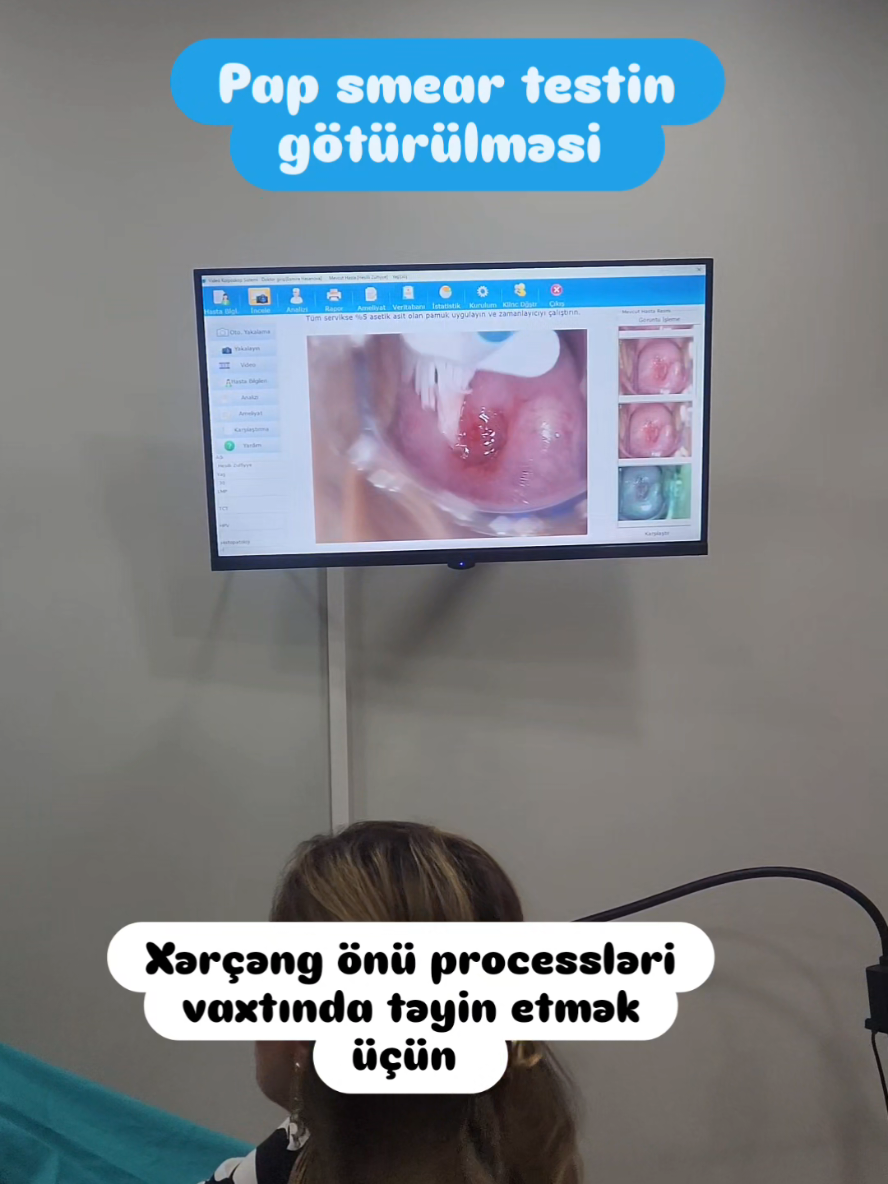 @Ginekoloq Esmira Hasanova