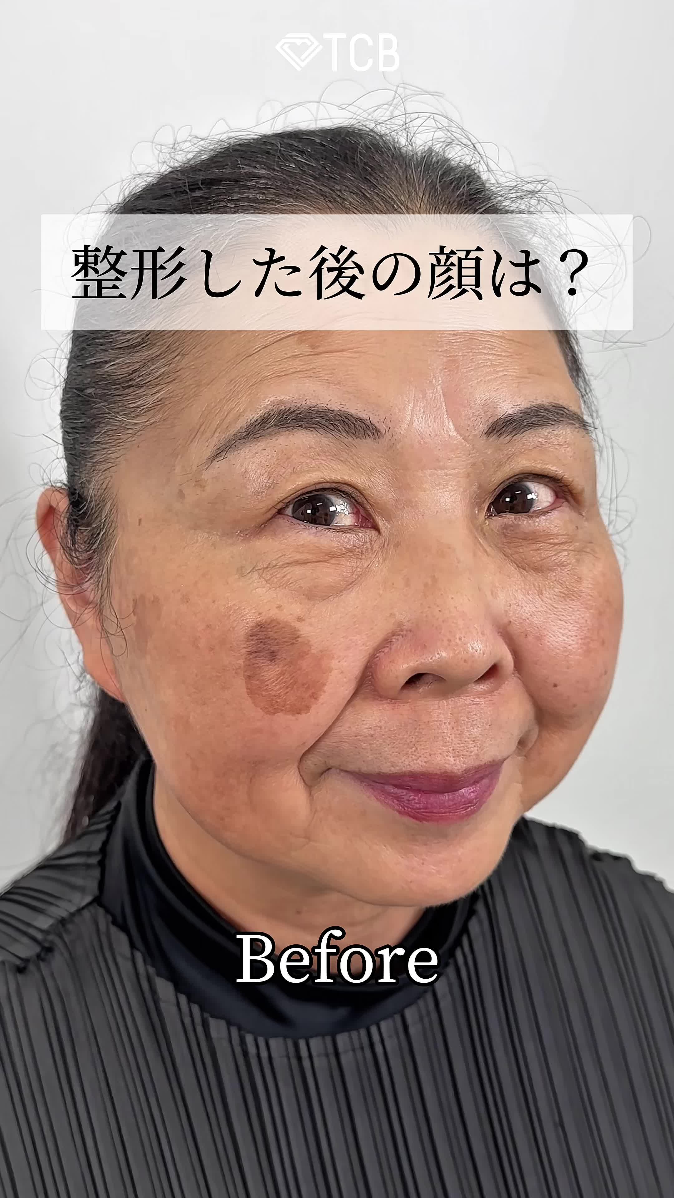 @【クマ取り/小顔整形】TCB京都駅前院 院長　橋本晋太朗
