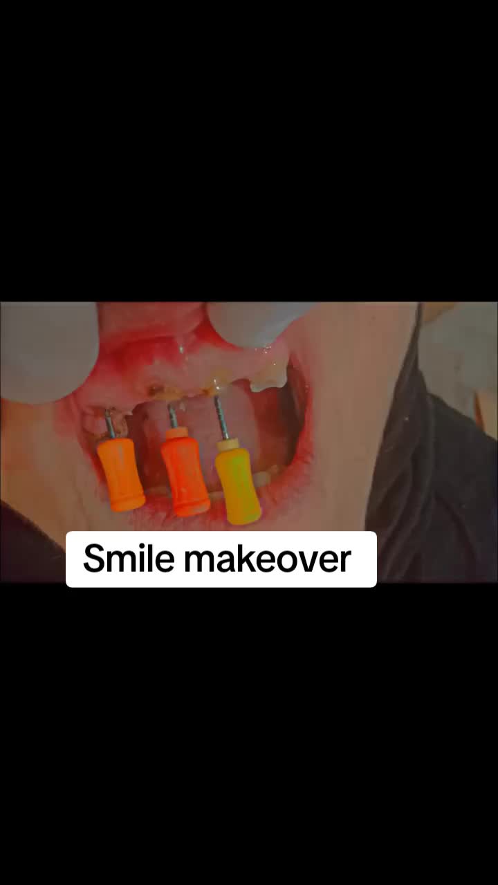 @Dr Adil khan 🦷🦷