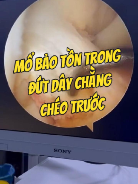 @Chuyên gia xương khớp