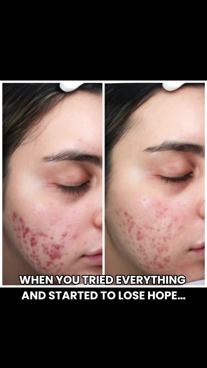 @crystal_clear_skin