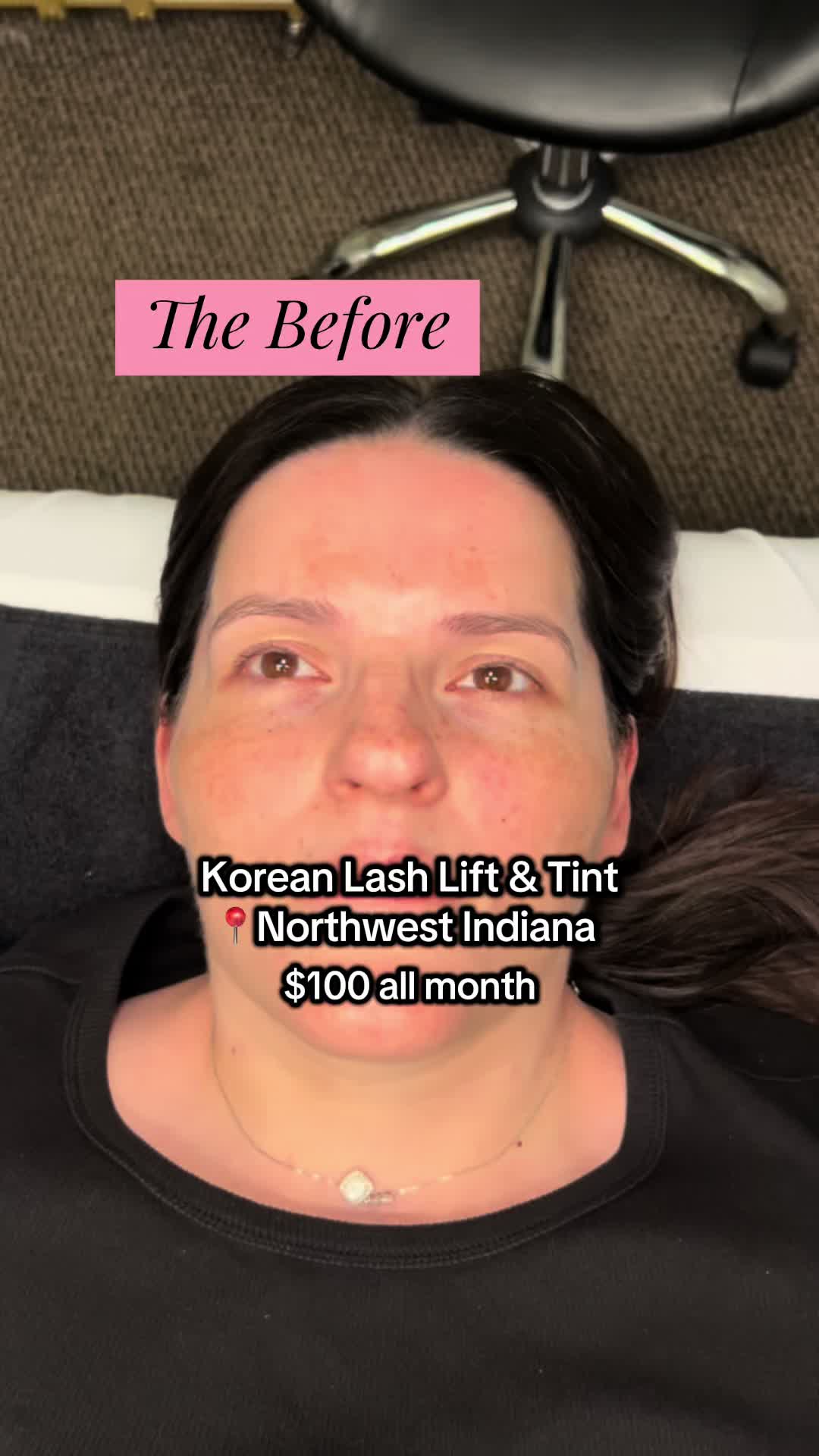 @Christy - NWI Aesthetic NP