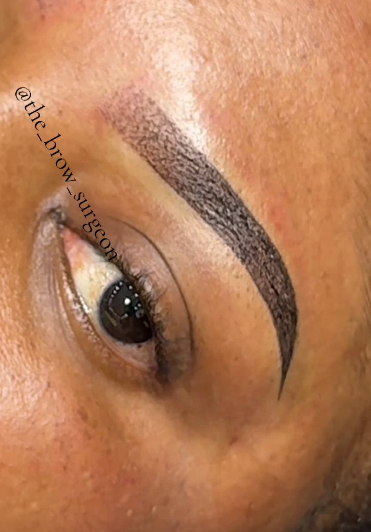 @the_brow_surgeon