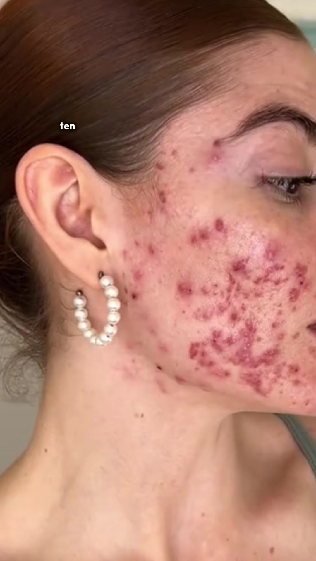 @Dermatóloga Cindy Burbano