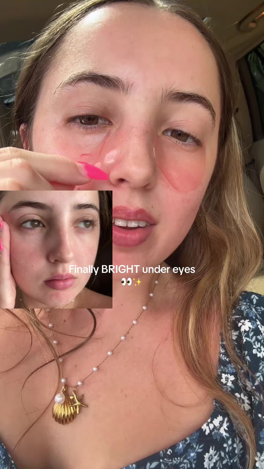 @Alicia Michelle