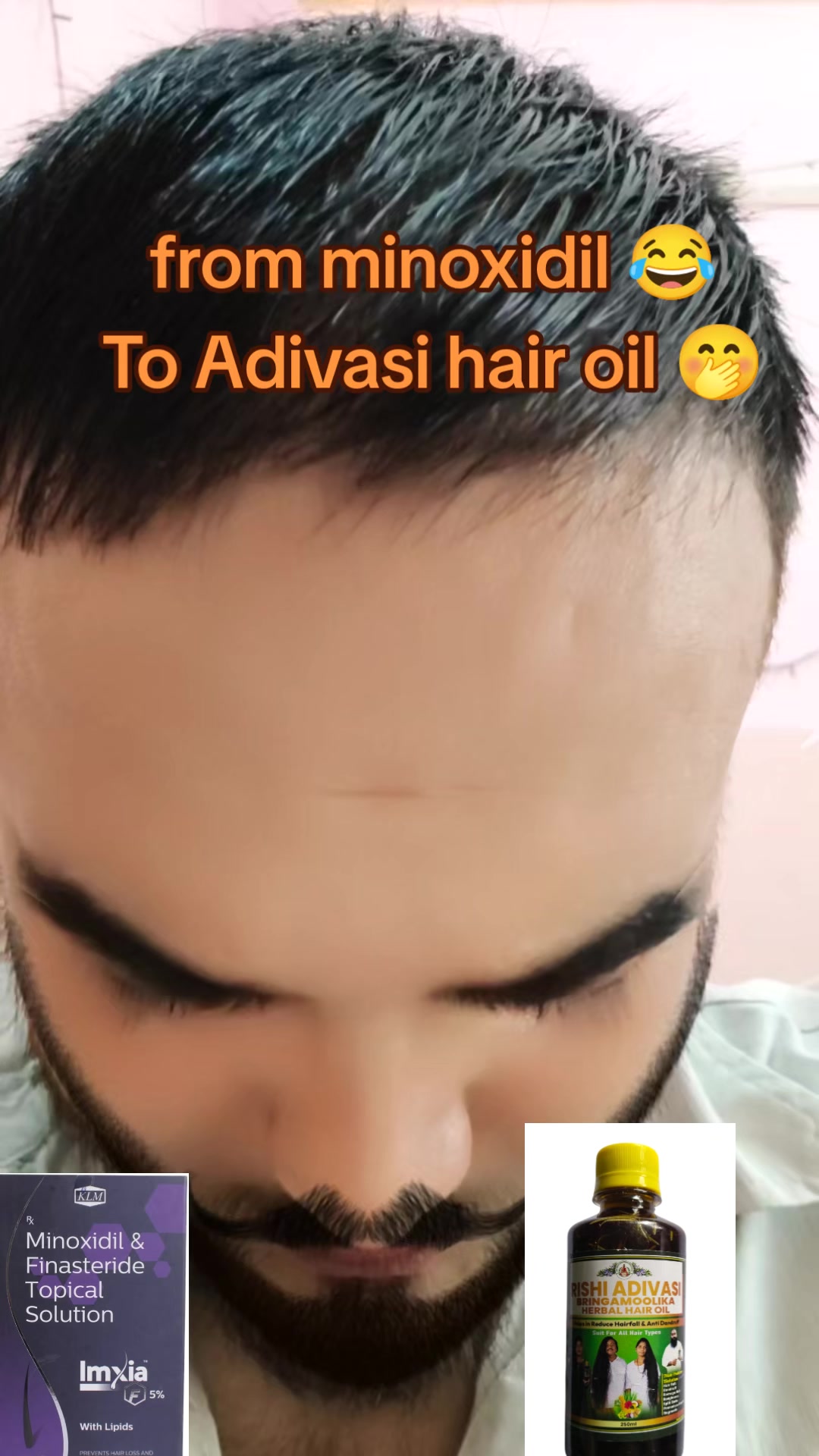 @DipeshSingh. 🕸🕷