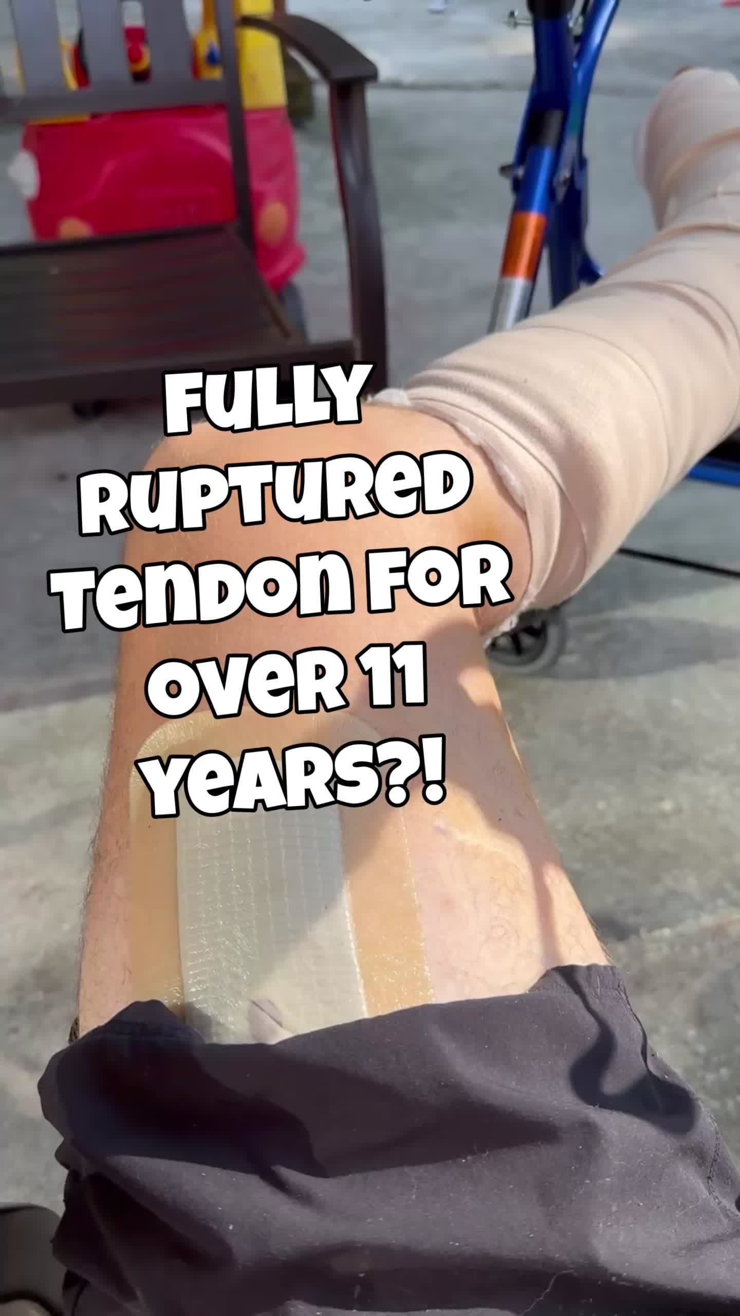@MarkyPi