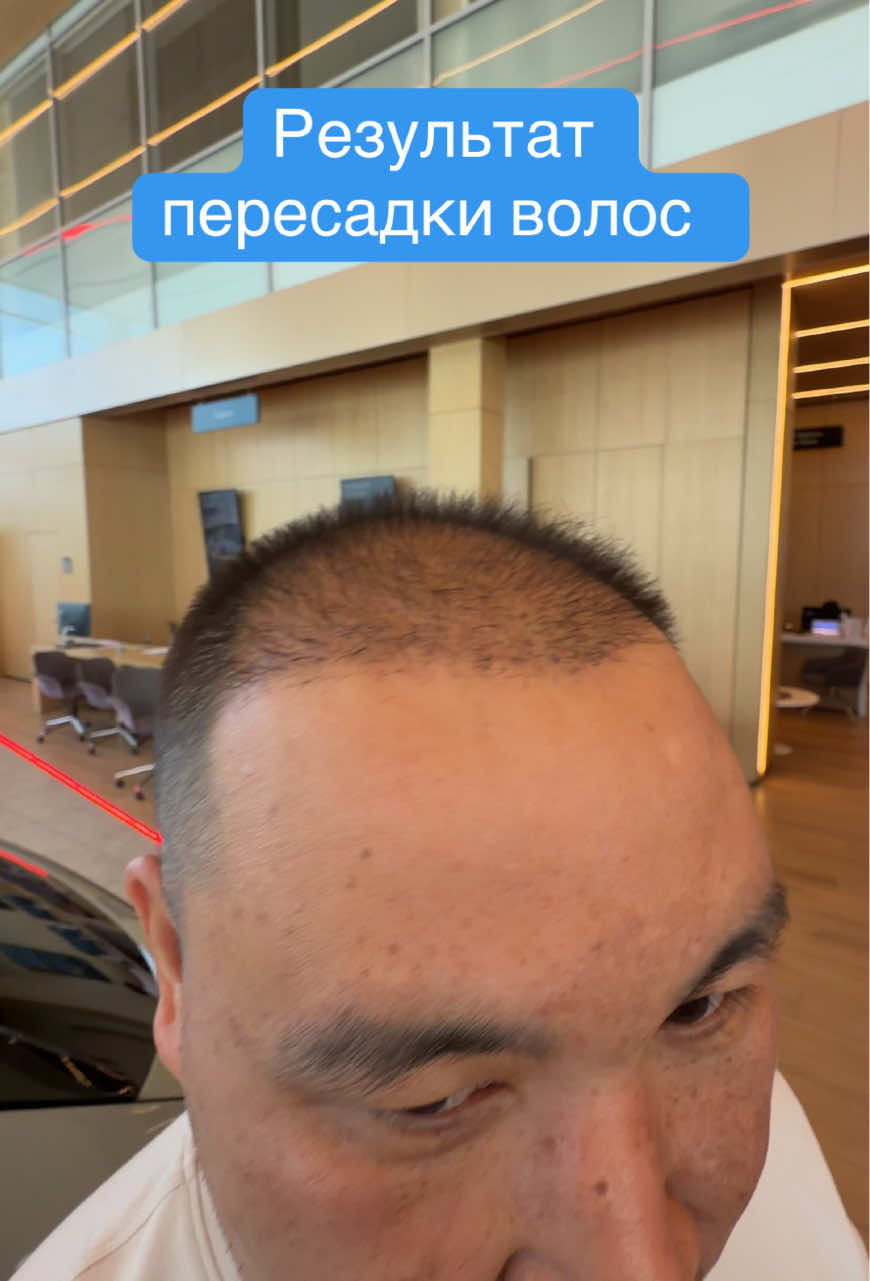 @🫁Асет Мурзабаев 🇰🇿