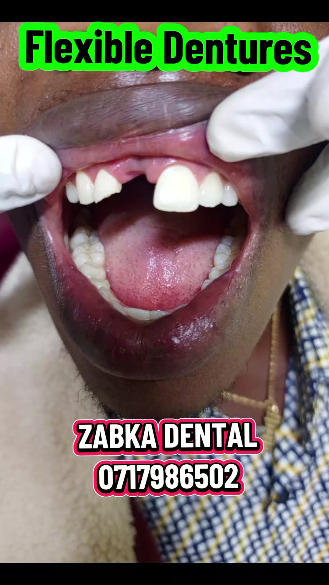 @Zabka Dental