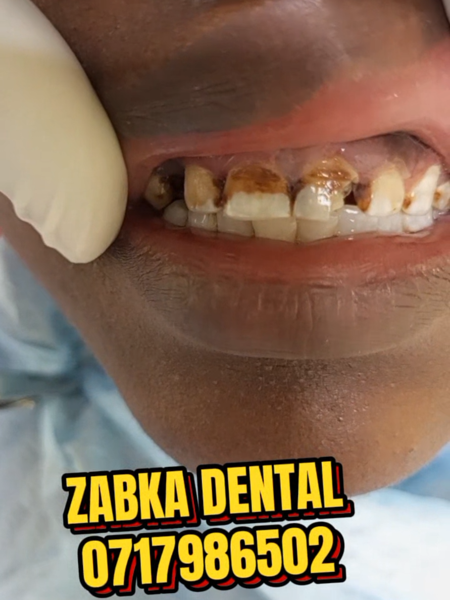 @Zabka Dental